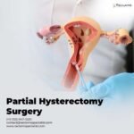 The Essential Guide to Partial Hysterectomy Surgery