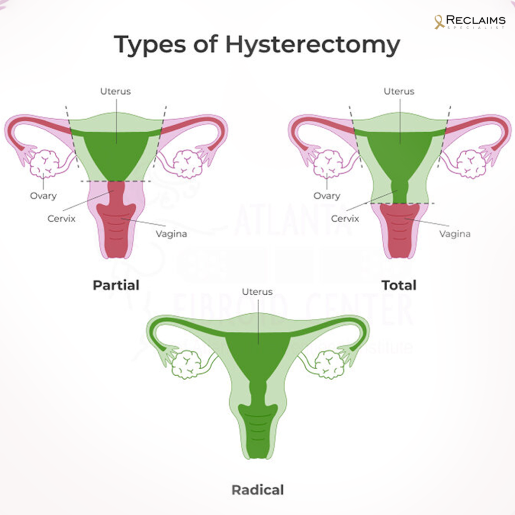 A medical team discussing partial hysterectomy surgery with a patient.
